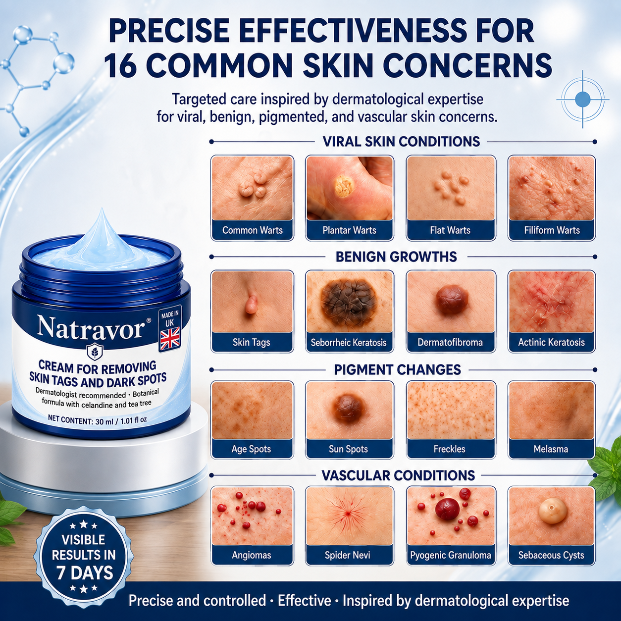 Natravor® 7-𝐃𝐚𝐲 𝐒𝐤𝐢𝐧 𝐓𝐚𝐠 & 𝐒𝐩𝐨𝐭 𝐄𝐫𝐚𝐬𝐞𝐫 𝐂𝐫𝐞𝐚𝐦 (Zero Pain, Zero 𝐒𝐜𝐚𝐫𝐬 Formula) 💎